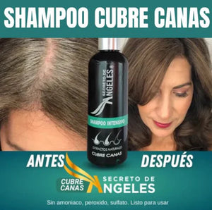 SHAMPOO ANTICANAS